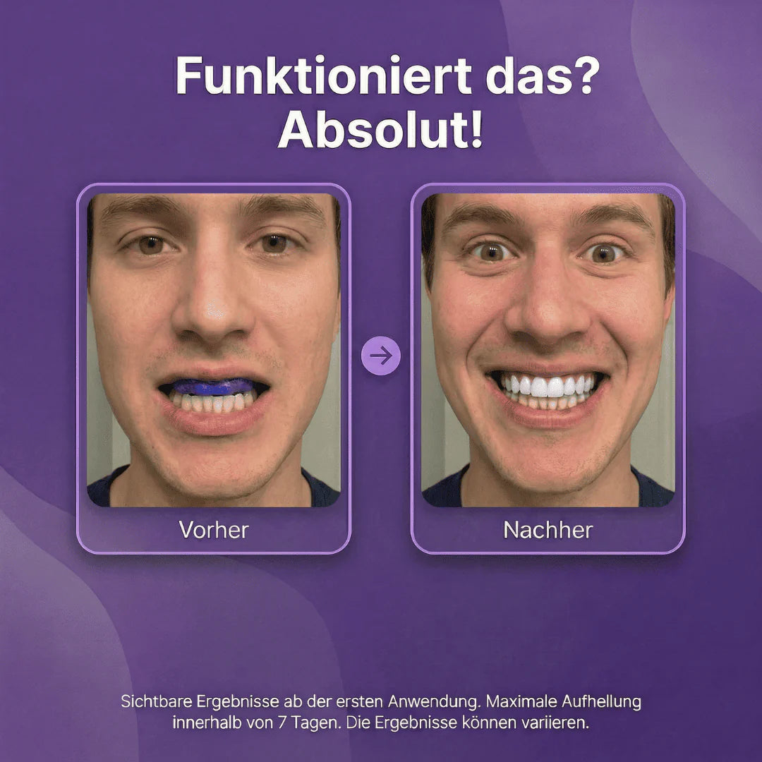 Vioren - Lila Zahnweiß-Streifen