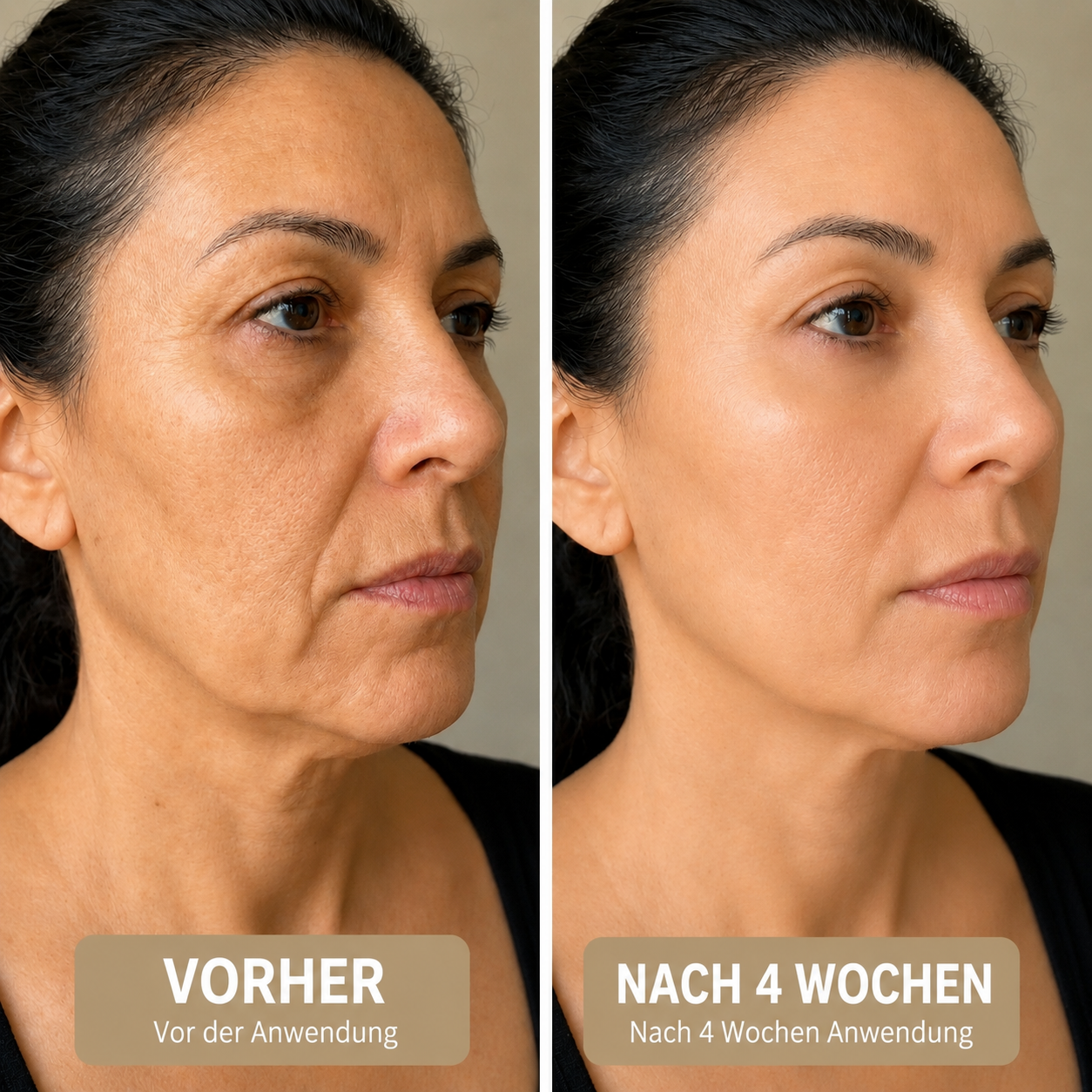 Vorher und nachher in 4 Wochen — entspanntere und strahlendere Haut